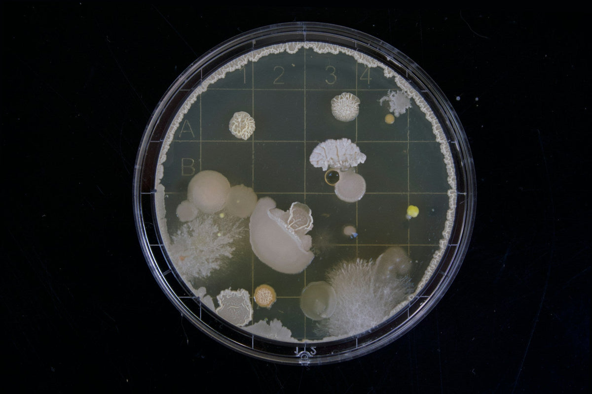 Helicobacter pylori (H. pylori) bakterija